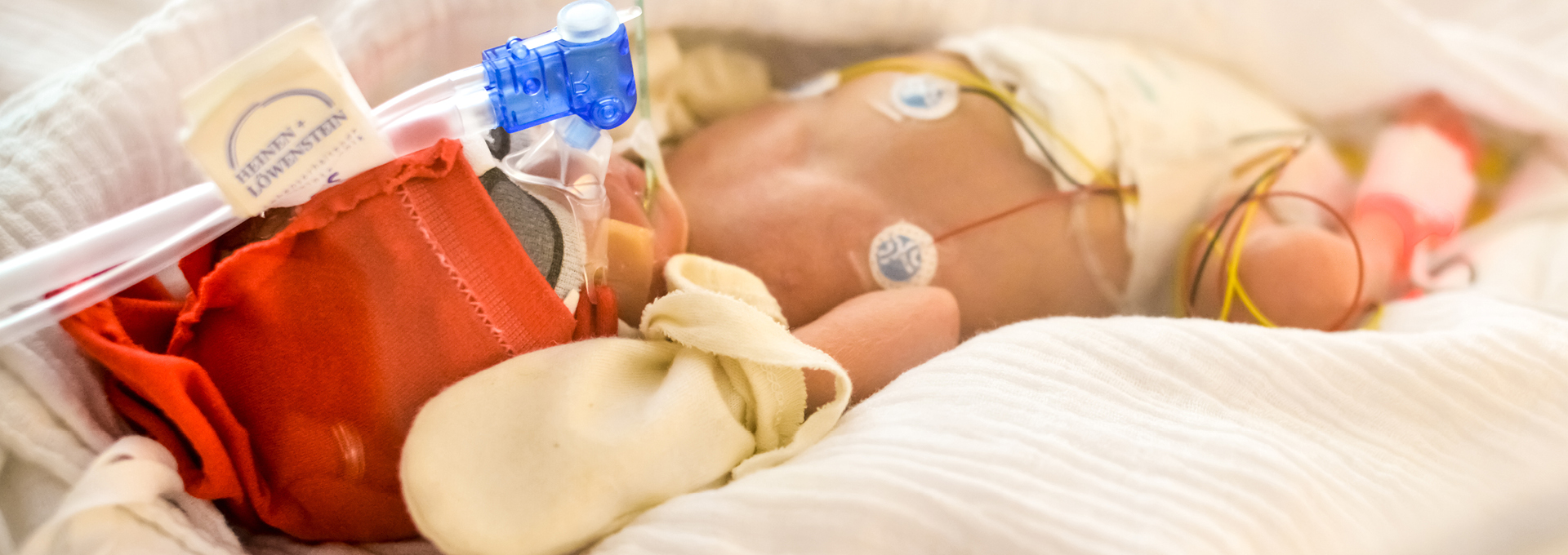 Frühgeborenes Babys, das beatmet wird