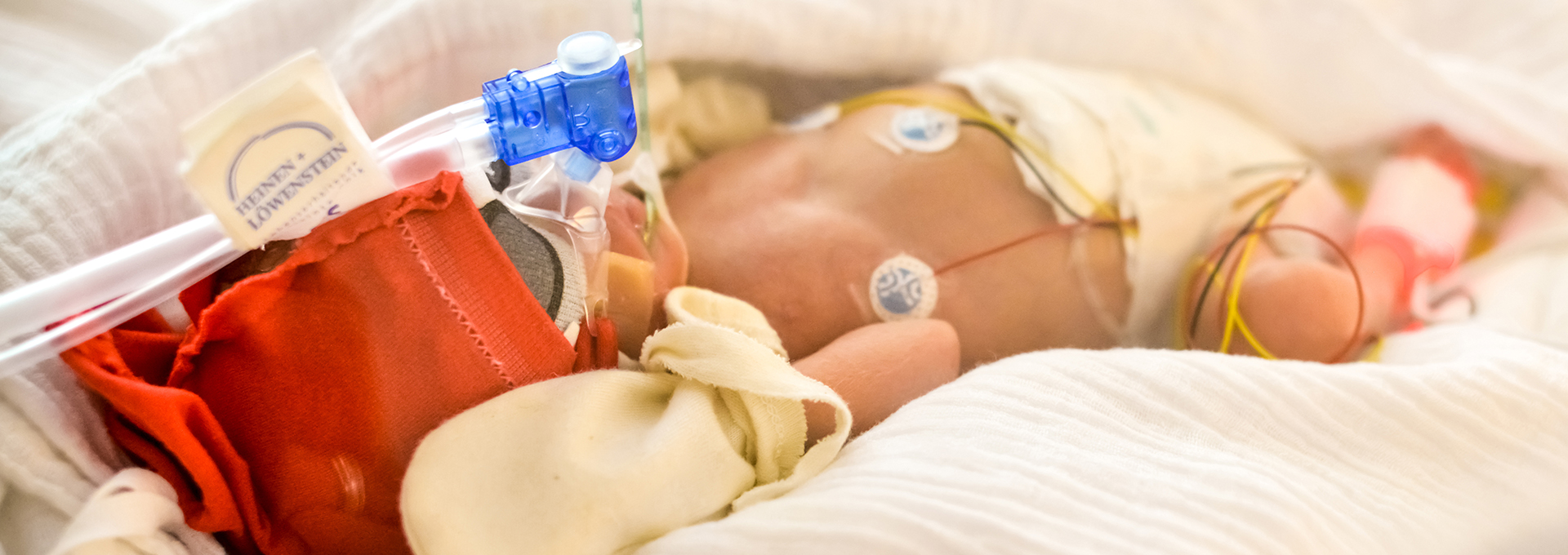 Das Bild zeigt ein Frühgeborenes in einem Inkubator, das mit verschiedenen medizinischen Geräten verbunden ist. Das Baby liegt auf einer weißen Decke und ist mit Sensoren und Kabeln versehen, die Vitalparameter überwachen. Es trägt eine rote Schutzmaske über dem Kopf und hat eine Atemhilfe, die durch ein blaues Ventil verbunden ist. Das Bild vermittelt eine ruhige und behütete Atmosphäre, während es die intensive medizinische Betreuung eines Neugeborenen darstellt.