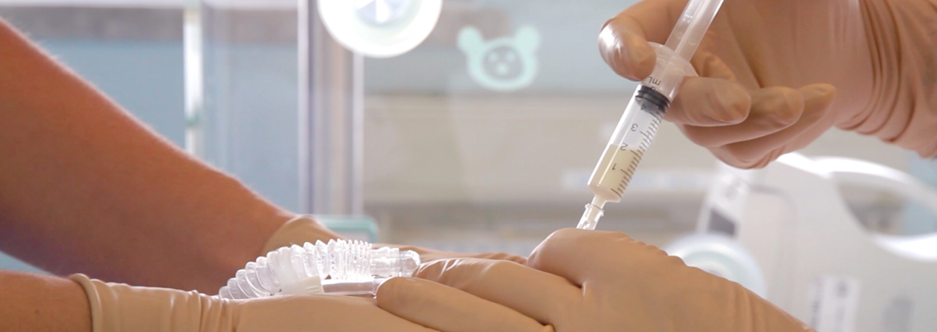 Surfactant wird gespritzt