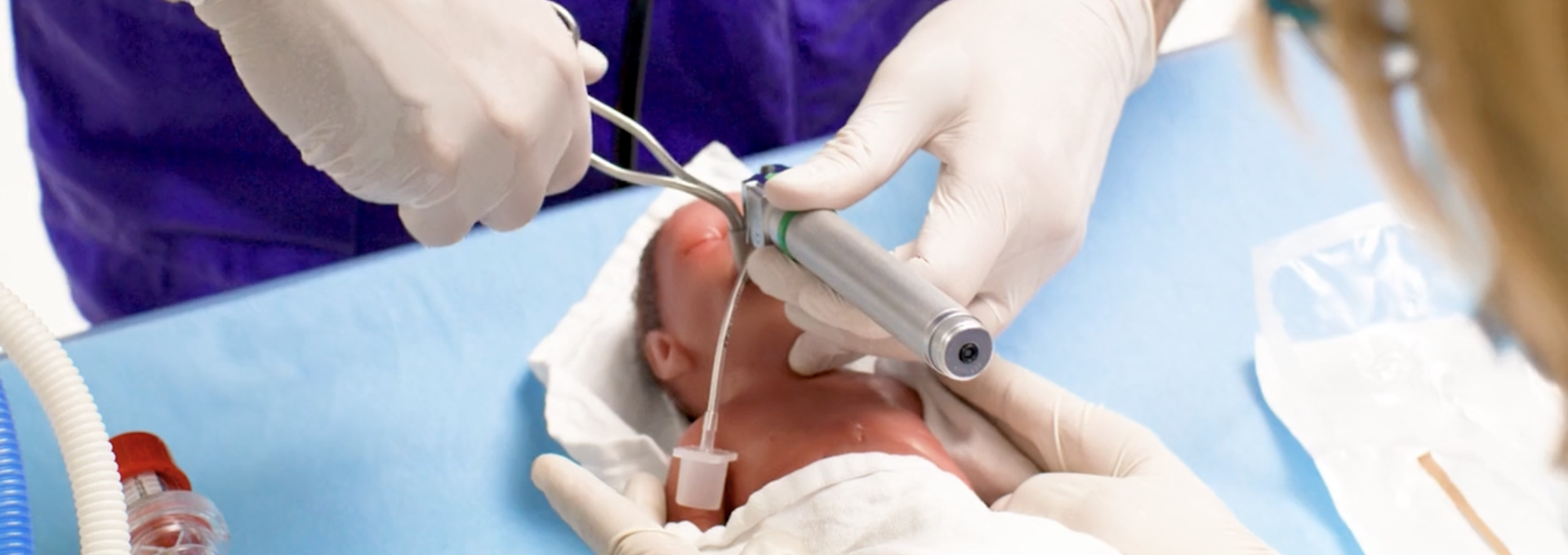 Medizinisches Fachpersonal verabreicht einem Frühgeborenen mit Hilfe eines Laryngoskops und einer Sonde eine Surfactant-Therapie zur Behandlung eines Atemnotsyndroms.