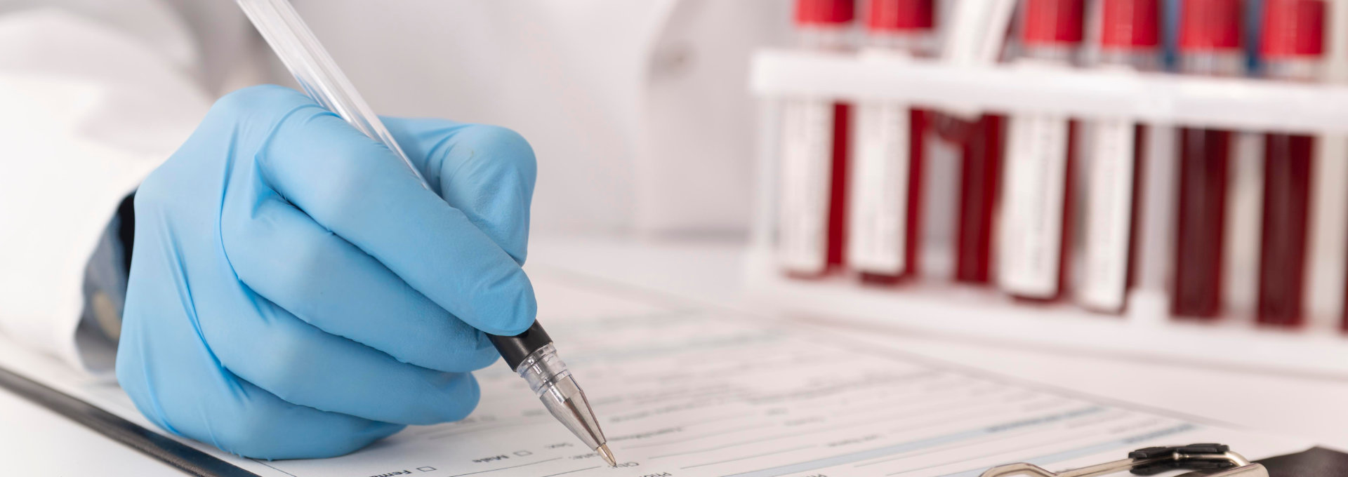 Hand in blauem Gummihandschuh hält einen Kugelschreiber und füllt ein Formular aus, in der anderen Hand hält die Person Blutproben
