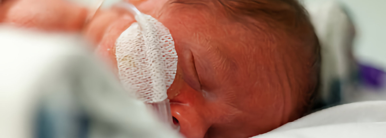 ein Baby mit einem Schlauch im Gesicht