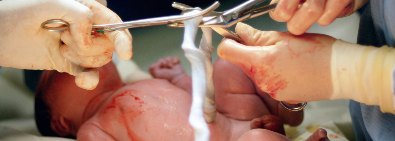 ein Baby, das zur Welt kommt