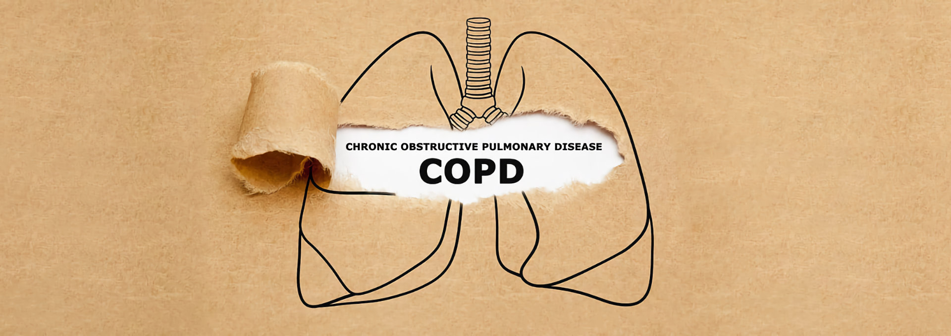 "Illustration einer Lunge auf braunem Hintergrund mit einem aufgerissenen Papierbereich, der den Text 'Chronic Obstructive Pulmonary Disease (COPD)' freilegt. Die schematische Darstellung der Lunge und der Text sollen auf die Krankheit COPD hinweisen.